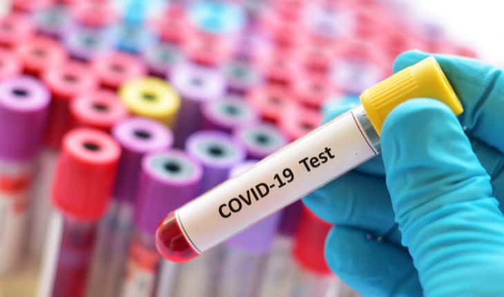 Covid-19: TAPb accelerates clinical trials by providing patient samples