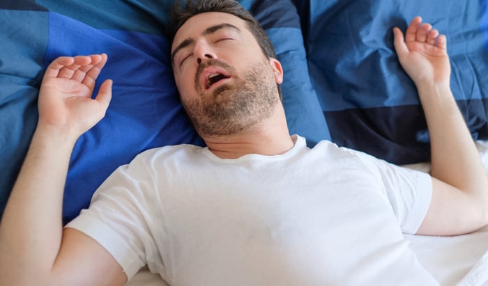 Researchers reduce severity of sleep apnoea