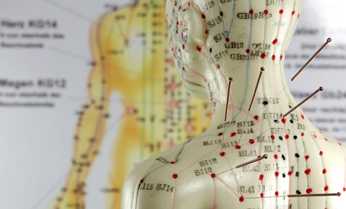 The benefits of acupuncture for cancer patients and survivors